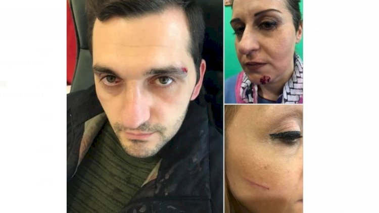    Ermənistanda mitinq keçirənlər döyüldü   