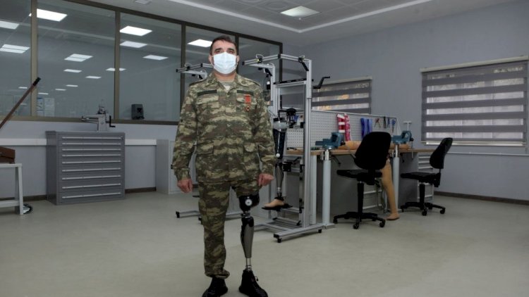   Azərbaycanda ilk yüksək texnologiyalı protezlər hazırlanıb -   Fotolar