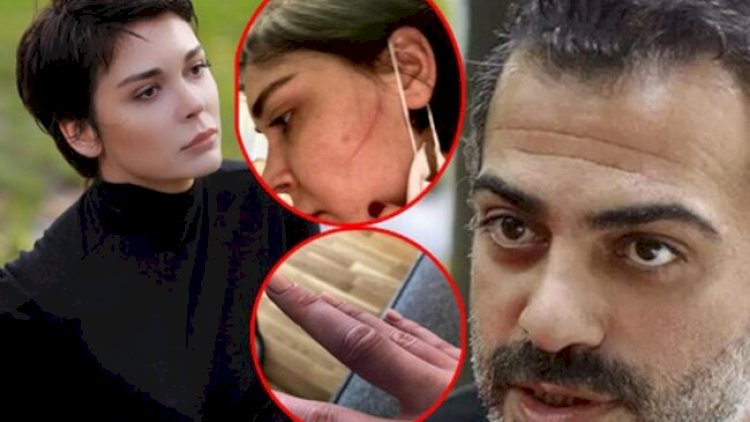    “Məni döyüb, yarıçılpaq videomu çəkdi” - Foto   