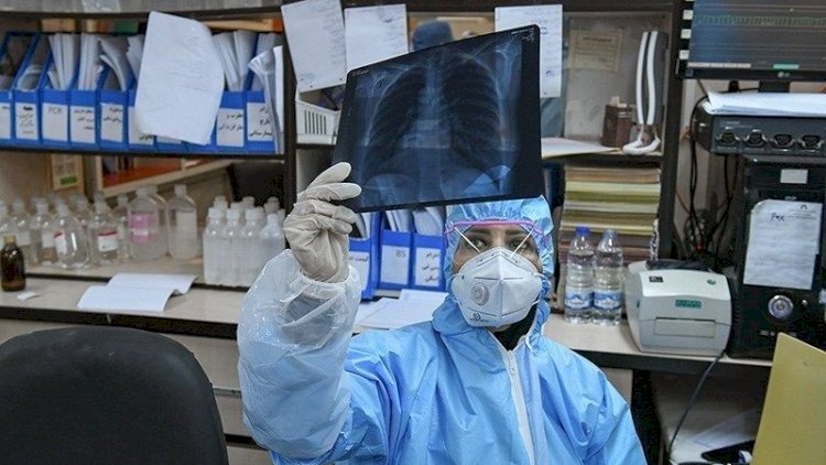    Koronavirusun daha bir ağır əlaməti aşkarlandı     