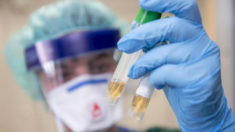   Azərbaycanda koronavirus testinin “əl yandıran“ qiyməti - Video   