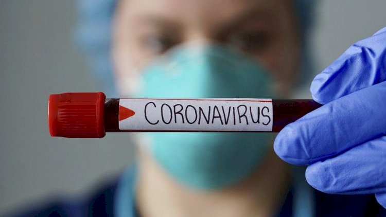    Azərbaycanda son sutka ərzində virusa yoluxanların sayı açıqlandı   