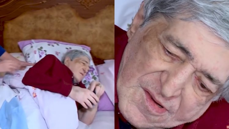    Rəmişə qaraciyər köçürüləcək   - Video