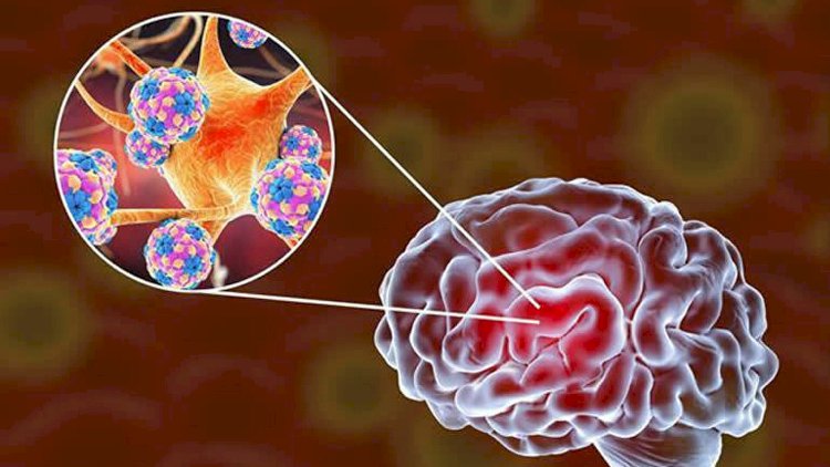    Koronavirus uzun müddət beyin və bağırsaqlarda qalır   - Alimlər