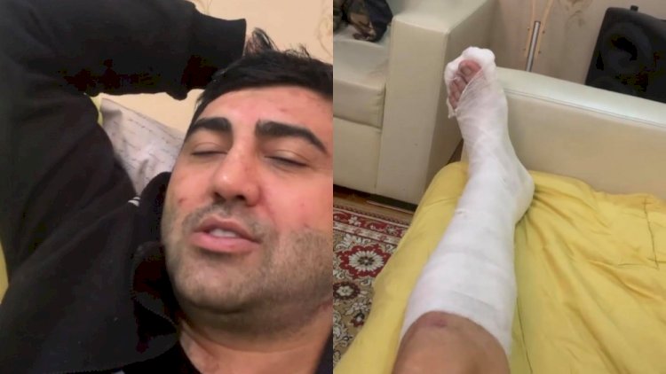    Vüqarın ayağı sındı, əməliyyat olunacaq   