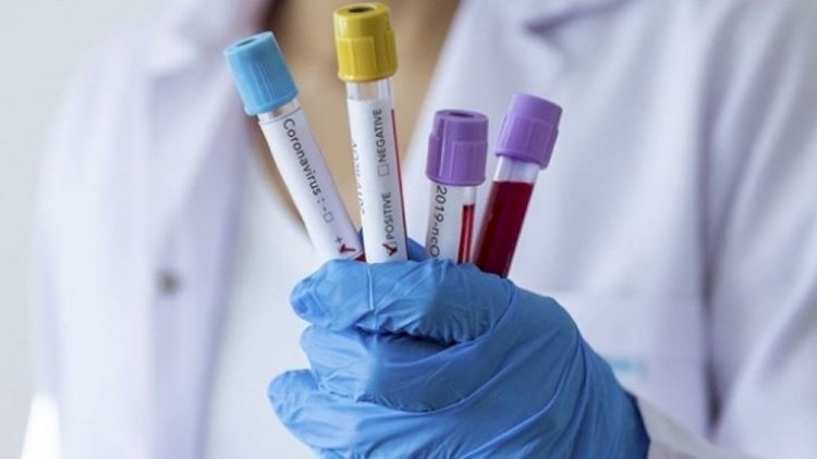    Koronavirus peyvəndi ilk dəfə uşaqlar üzərində sınaqdan keçiriləcək   