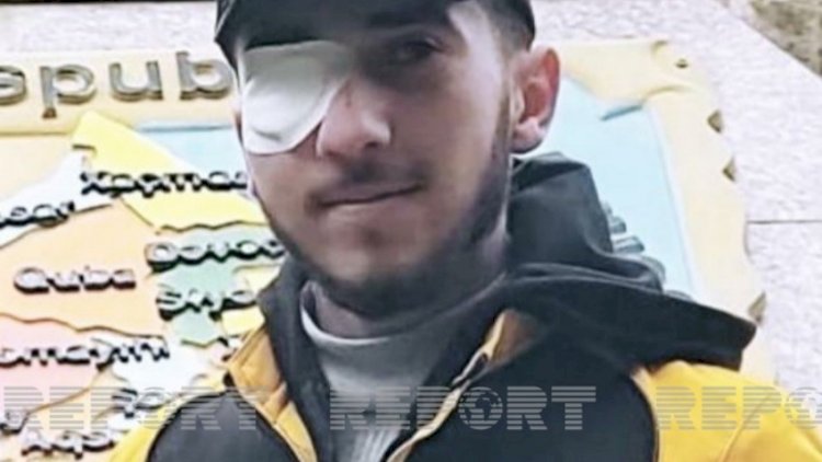    Vətən müharibəsinin rəssam qazisi gözündən əməliyyat ediləcək - Fotolar   