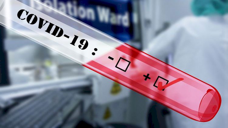    Bu xəstəliyi olanlar üçün koronavirus xüsusilə təhlükəlidir   