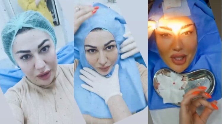    Rəqqasə Fatimə əməliyyat olundu - Görüntülərini paylaşdı   + Video