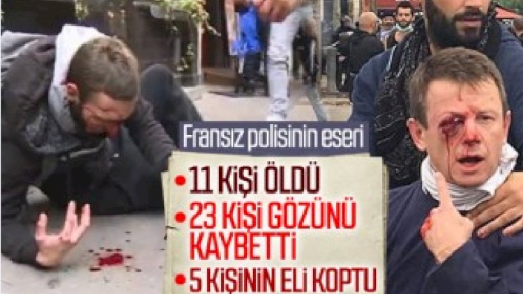    Fransa və digər ölkələr insan haqlarını pozur -   “Amnesty International”