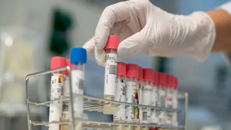    Koronavirus araşdırması üçün könüllülər axtarılır   - 10 800 manat veriləcək