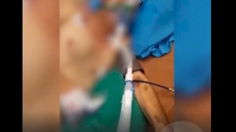    Koronavirusa yoluxmuş Arif Quliyevin xəstəxanadan görüntüləri yayıldı - Video   