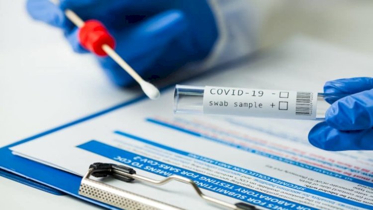    Virus dünyanı cənginə alıb: Yoluxanların sayı 154 milyonu ötdü   