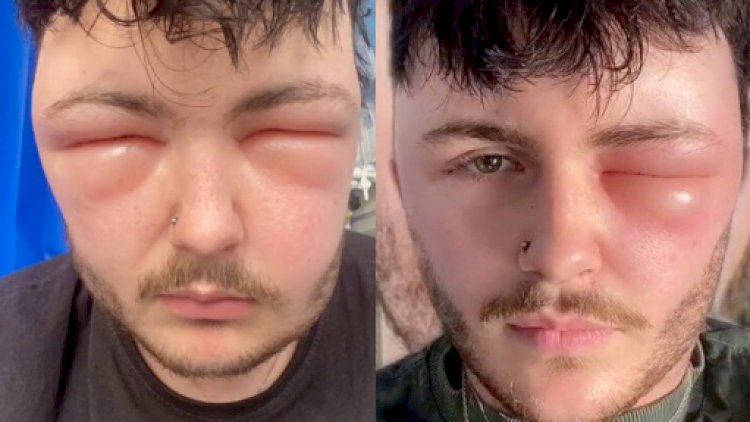    Saç boyası məşhur blogeri tanınmaz hala saldı   - Fotolar