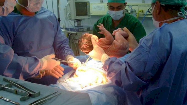    Bakıda əkizlər doğuş zamanı öldü   