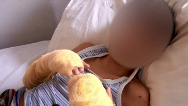    Bərdədə övladının əllərini yandıran ana barədə cinayət işi açıldı   