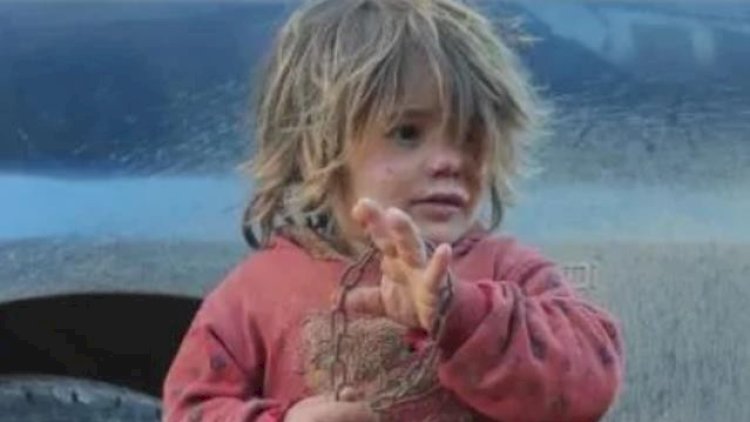    Atası tərəfindən zəncirlənən qız aclıqdan öldü - Foto   