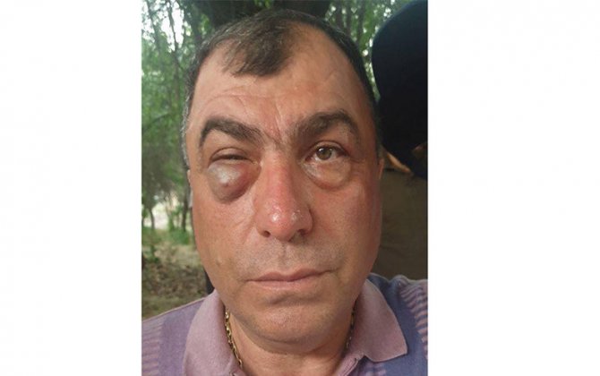 Paşinyançılar və polis Dərələyəzdə Köçəryan tərəfdarını bu günə saldı... - Foto 