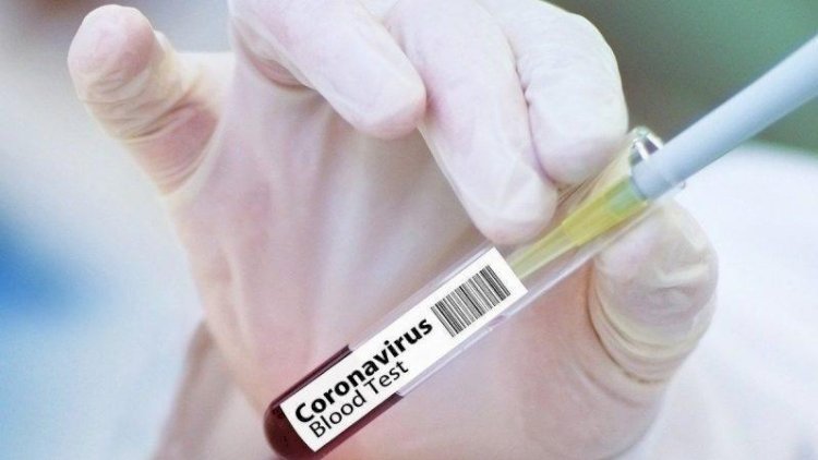    Bitmək bilməyən koronavirus - Azərbaycanda vəziyyət necədir? -   AÇIQLANDI