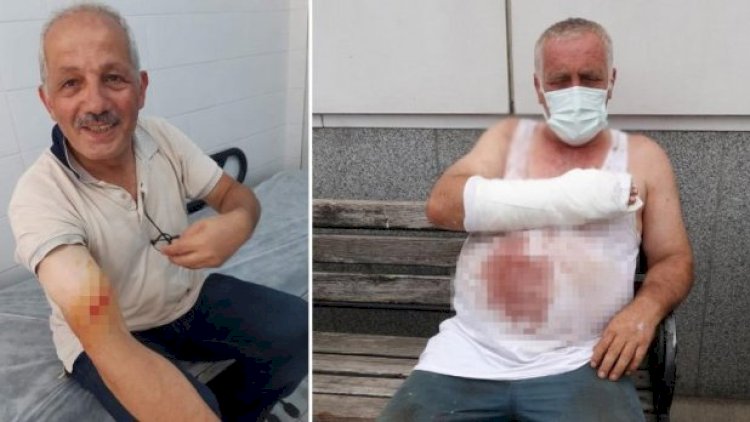    Trabzonda qurban kəsimi: Bələdiyyə başqanı da daxil olmaqla 127 nəfər yaralandı   