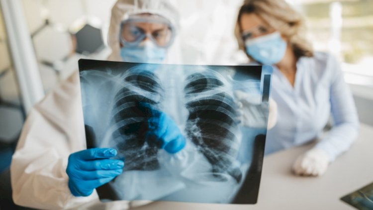    Koronavirus pandemiyasının bitəcəyi tarix açıqlandı   