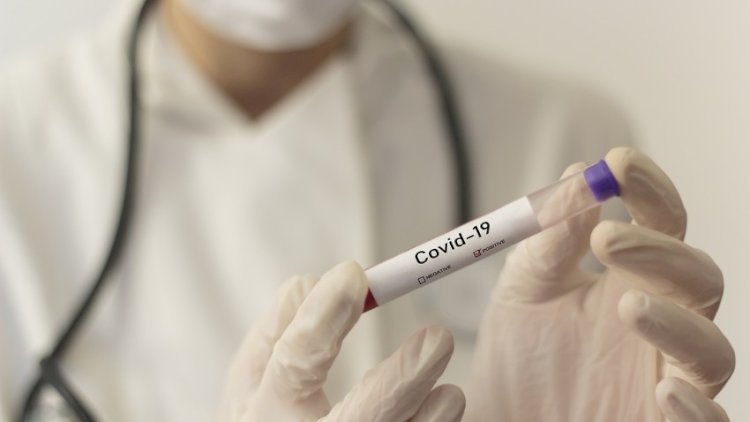    Azərbaycanda vəzifəli şəxs koronavirusdan öldü   