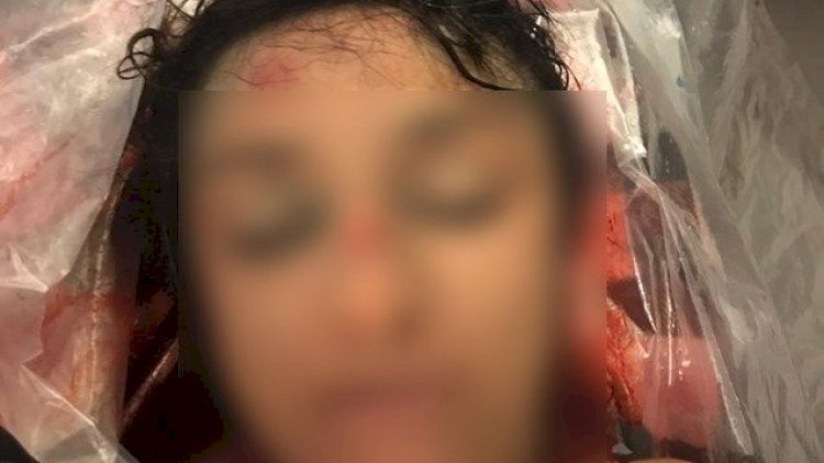    Bakıda dəniz sahilində qadın meyiti tapıldı    