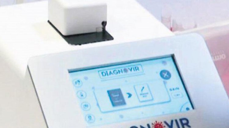    Bu cihaz koronavirusu 10 saniyəyə aşkar edir    