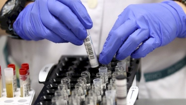    Ermənistanın son koronavirus statistikası açıqlandı   