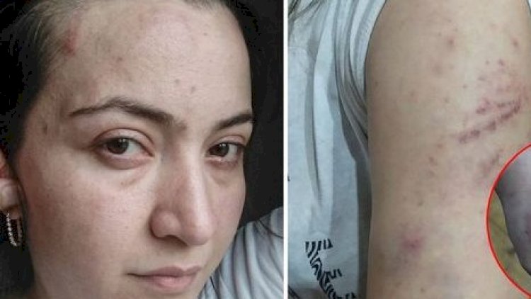    Polisin qətlə yetirdiyi qadının qardaşı sirləri açdı   