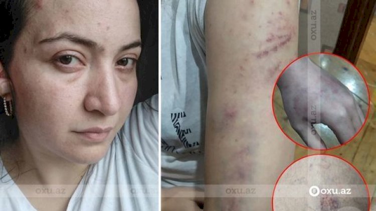    Polis bölməsində öldürülən qadının ailəsi danışdı - Video   