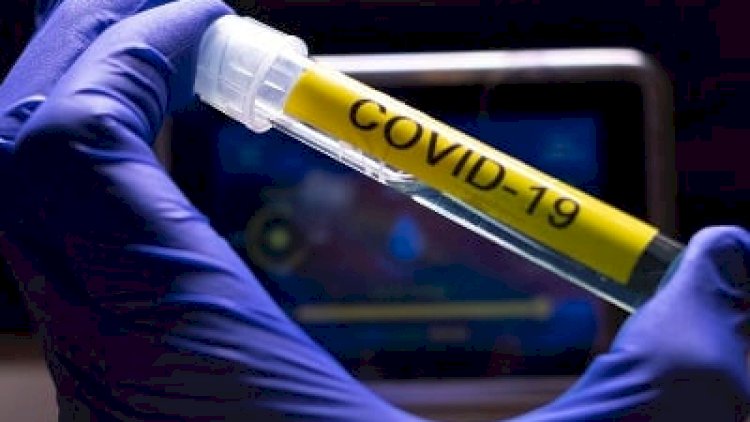    7077 ölüm - Ermənistanda COVID-19   