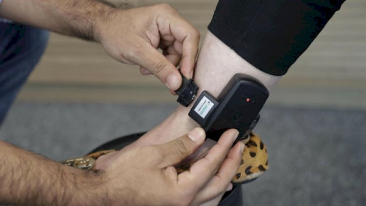   Azərbaycanda ginekoloqa elektron qolbaq taxıldı   