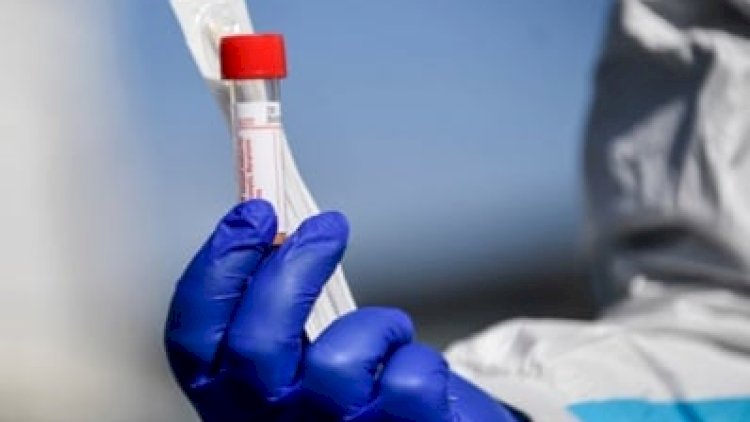    Dövlət Agentliyi 4-cü dozanı vurdurmağı məsləhət gördü   