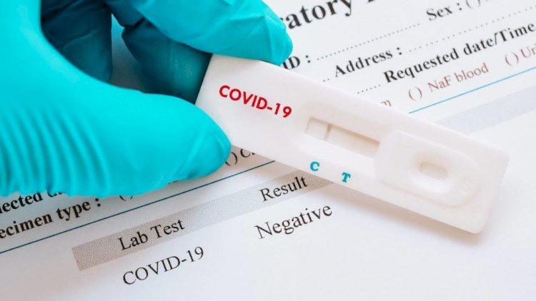    Azərbaycanda koronavirus testi istehsal olunur   