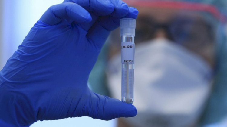    Daha bir ölkdə “Omicron” ştammı aşkarlandı   