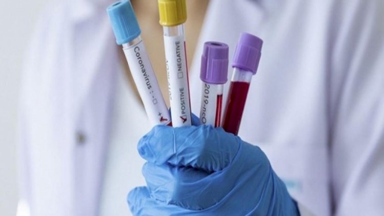    Qonşuda koronavirus dəhşəti: 24 saatda 60 nəfər öldü   