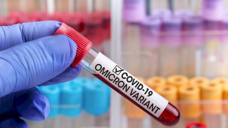    Qazaxıstanda bircə bu çatışmırdı: “Omikron“ aşkarlandı   