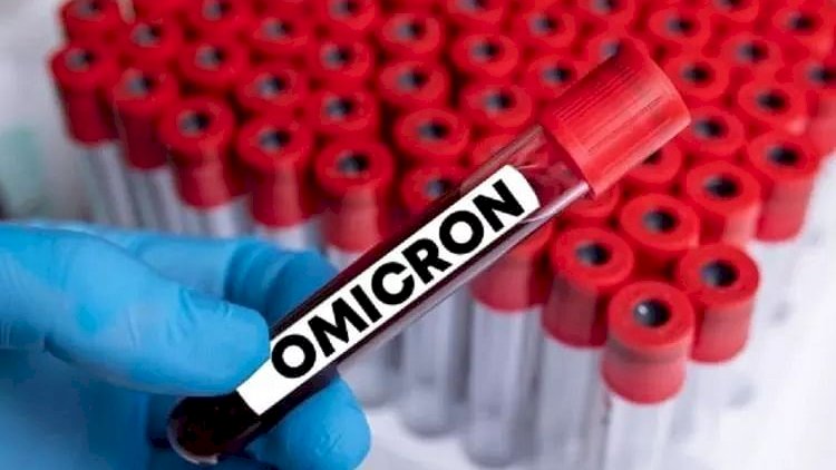    Azərbaycanda “Omicron“a yoluxanların vəziyyəti necədir? - Açıqlama   