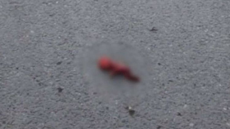    Azərbaycanda tualetdə insan dölü tapıldı   