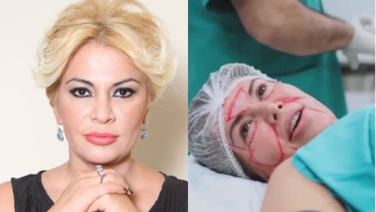    Ulvira yenidən estetik əməliyyat etdirdi – Və dəyişdi... - FOTOLAR   