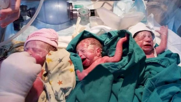    Bakıda koronaya yoluxan hamilələr üçəm və dördəm dünyaya gətirdi   - Foto