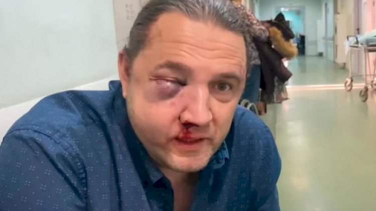    Rusiyanın sabiq deputatına hücum anının görüntüləri yayılıb    