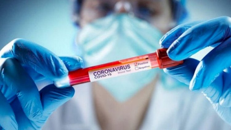   Azərbaycanda koronavirusa yoluxma sayı yenidən artdı,   28 nəfər öldü