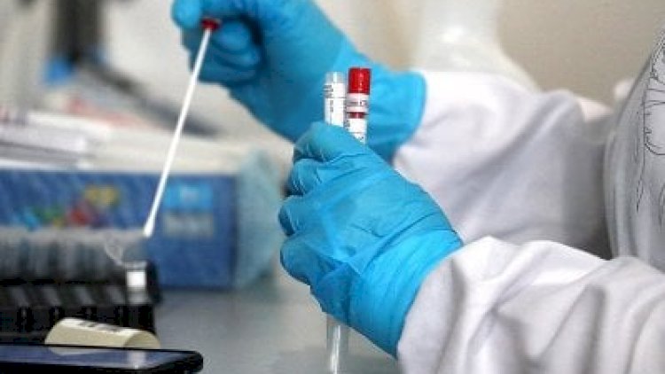    Ermənistanın son COVID statistikası:   8354 ölüm