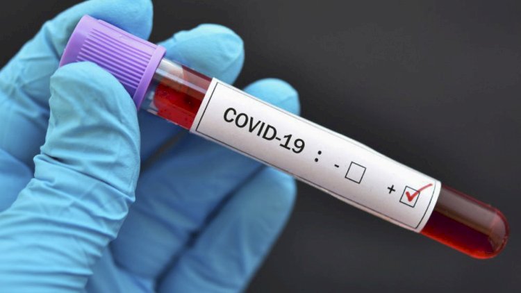    Rusiyada COVID-19: Ölənlərin sayı 351 mini keçdi   