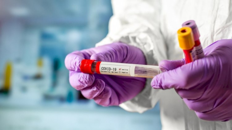    Azərbaycanda koronavirus STATİSTİKASI: 5 nəfər yoluxdu,   1 nəfər öldü