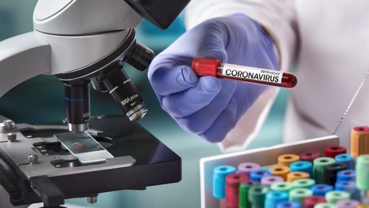    Son sutkada cəmi 2 nəfər koronavirusa yoluxub   