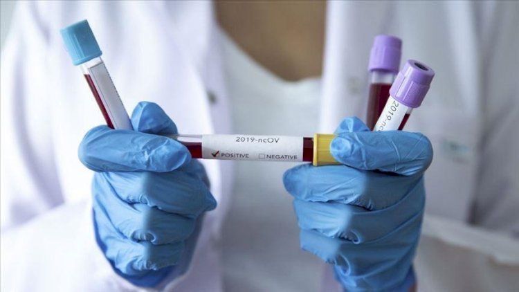    Gürcüstanda koronavirus kabusu: 1 həftədə 14 min yeni yoluxma   