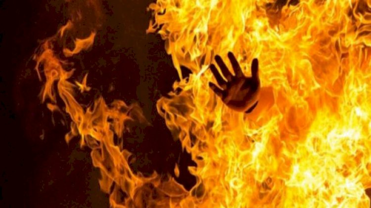    Bakıda özünü yandıran qadın öldü   